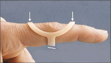 Oval-8 prstová dlažka<br /> pro fixaci a korekci malých kloubů prstů ruky